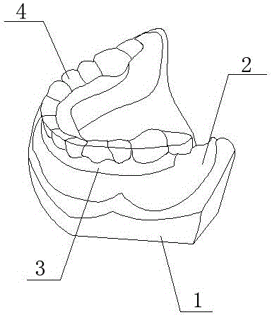 可調(diào)式輔助排牙頜位關系記錄牙托結(jié)構的制作方法附圖